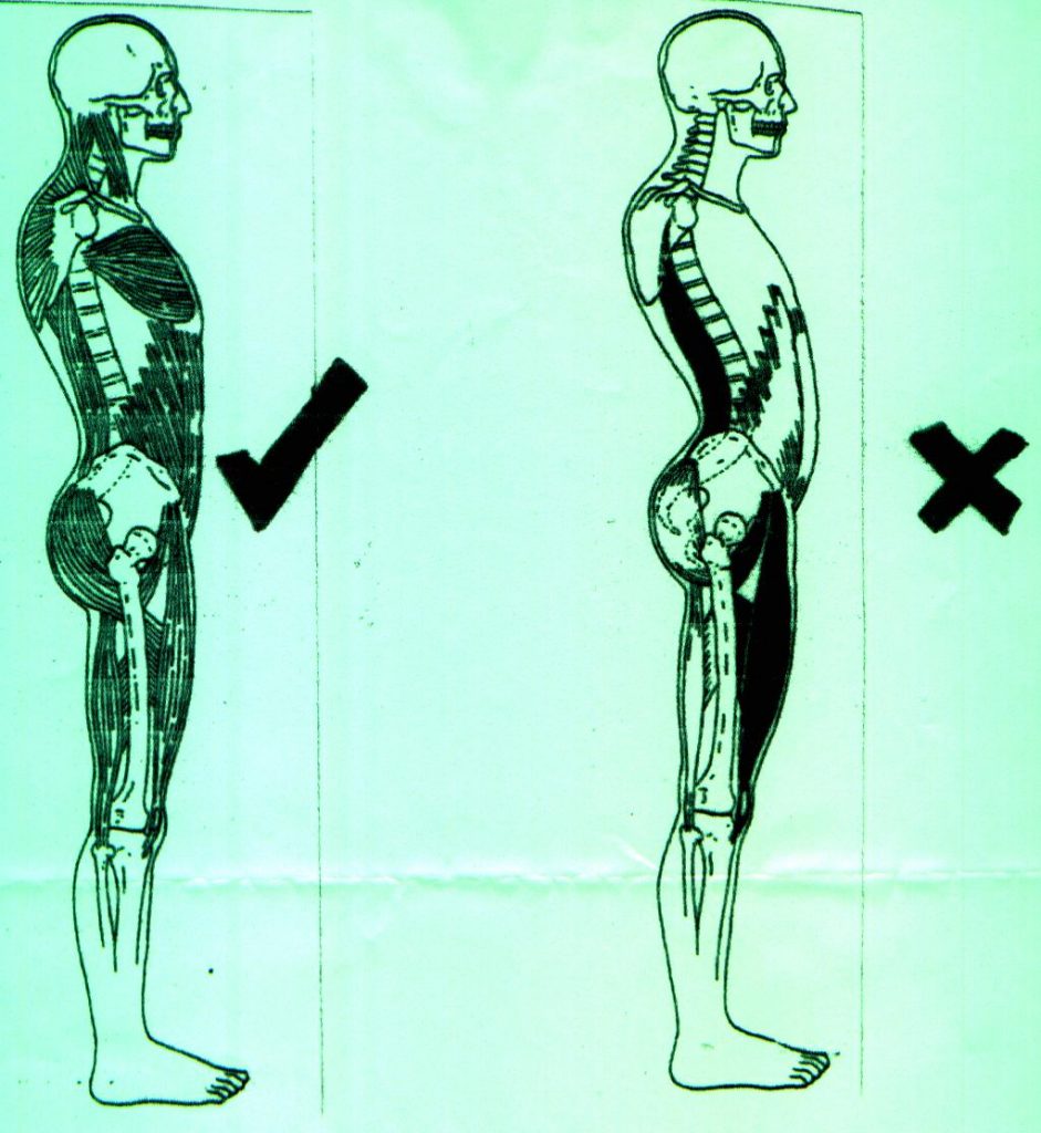Postural Correction, Spine Health